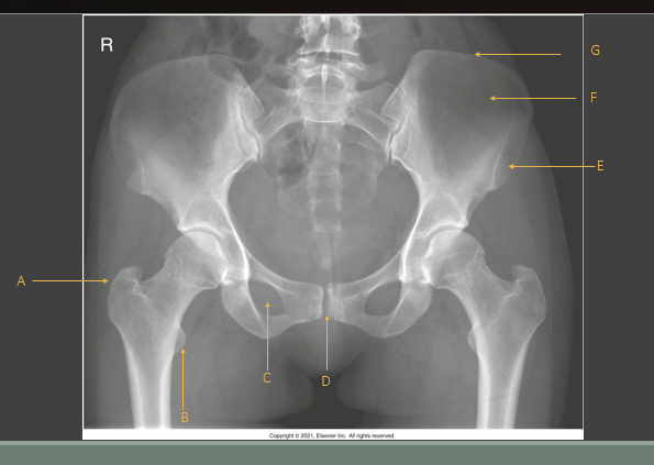 <p>what is A?</p>