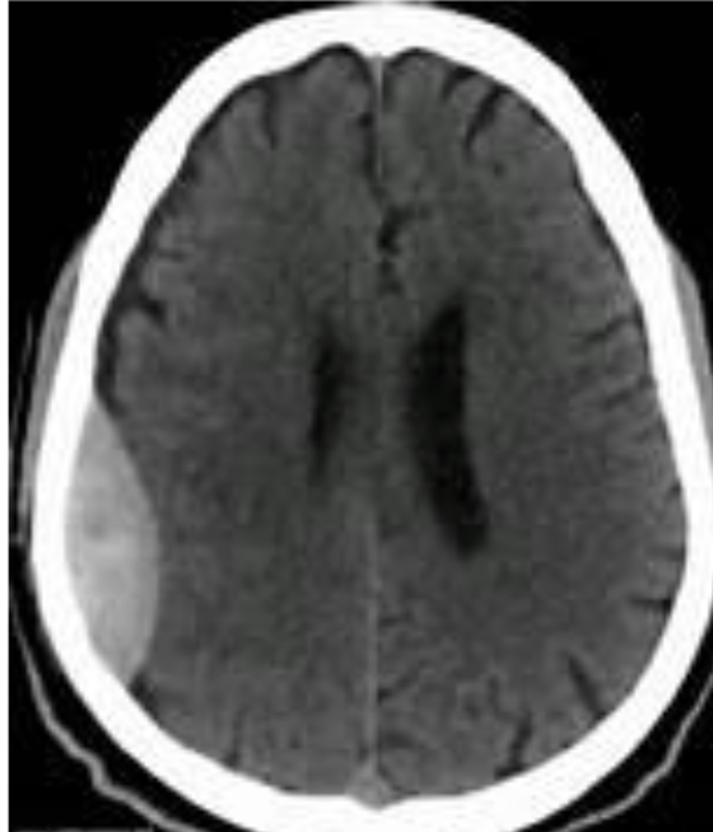 <p>What is the diagnosis?</p>