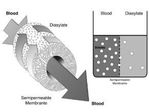 <p>Blood is separated from crystalloid solution or dialysate by a semipermeable membrane </p>