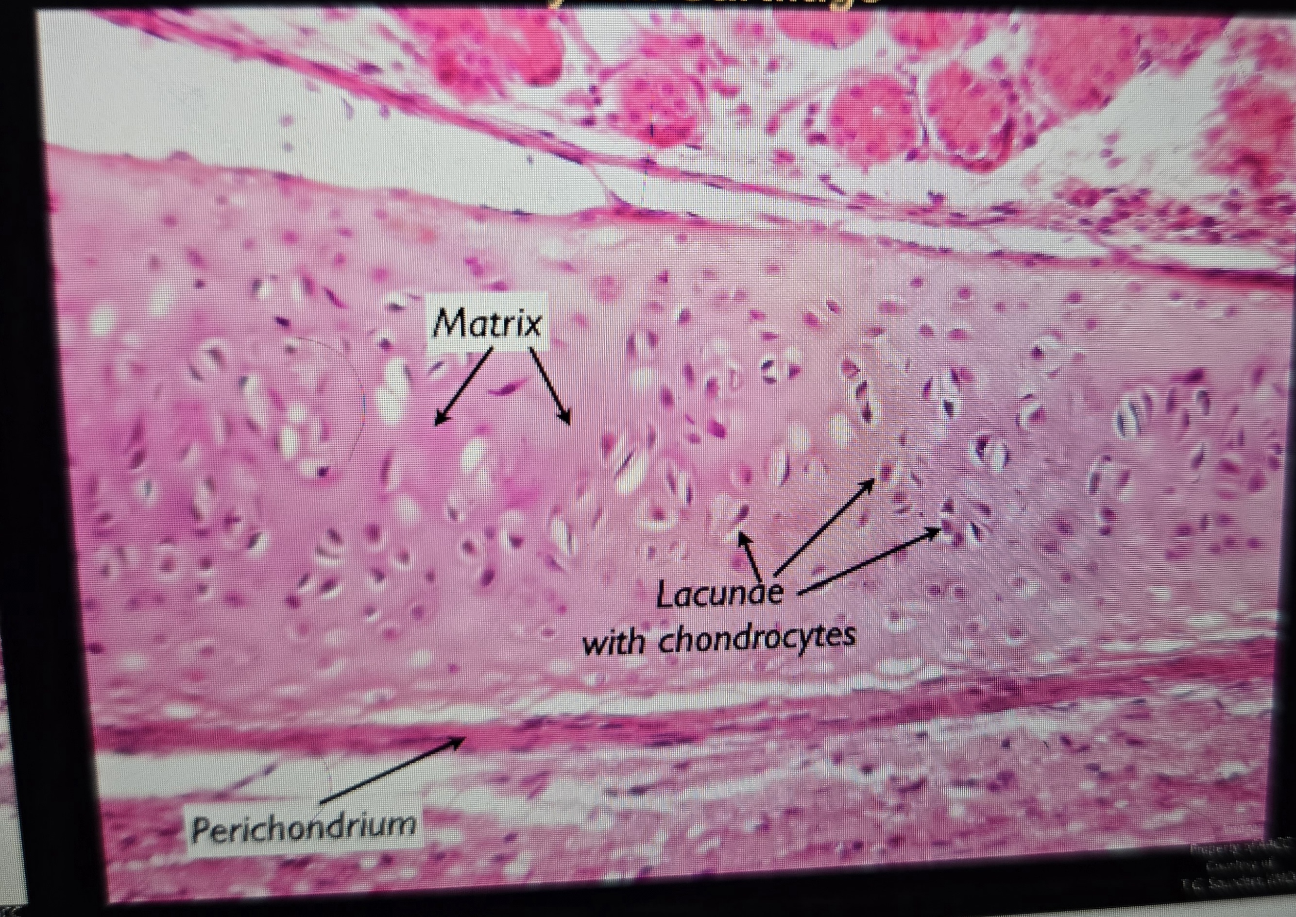 term image