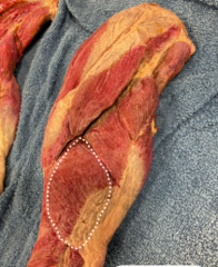 <p>Identify the muscle</p>