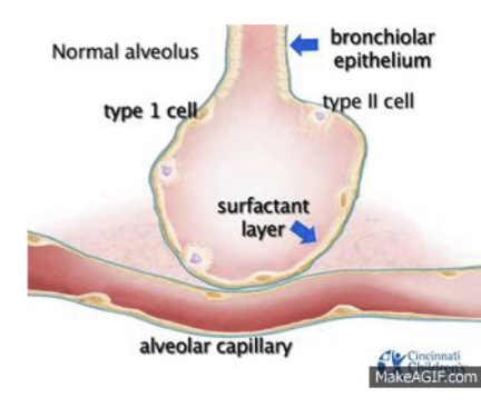 <p>They need <strong>pulmonary</strong> <strong>surfactant</strong> to <strong>prevent</strong> their <strong>lungs</strong> from <strong>collapsing</strong> and to <strong>transition</strong> from having their <strong>lungs</strong> <strong>filled </strong>with <strong>fluid</strong> to <strong>breathing</strong> <strong>air</strong> </p>