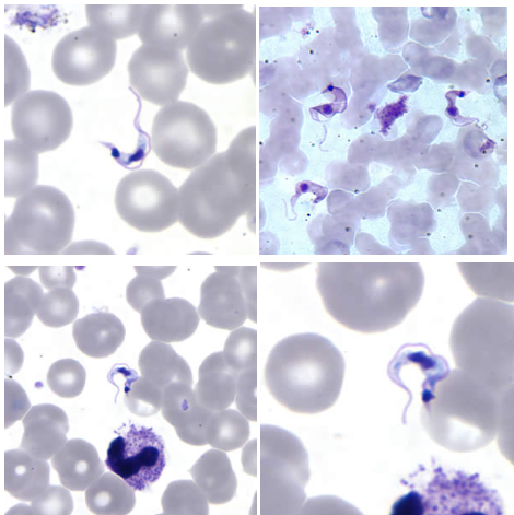 <p>Identify the parasite and its stage.</p><p>Disease:</p><p>Vector:</p><p>Transmission:</p><p>Infective stage:</p><p>Diagnostic stage:</p><p>Treatment:</p>