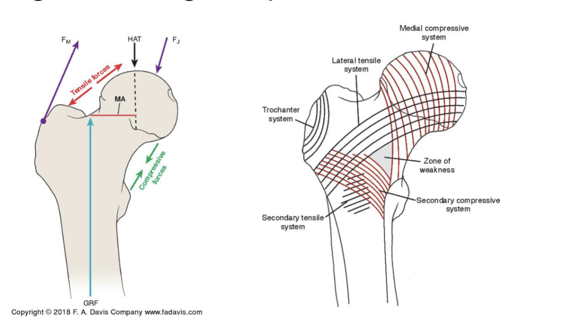 <p><strong>Femur neck: </strong>bending forces</p><ul><li><p><strong>greater trochanter → head (upper neck):</strong><em> tensile forces </em></p><ul><li><p>bad for neck b/c bone is NOT good at handling tension</p></li></ul></li><li><p><strong>lesser trochanter → head (concave, lower neck): </strong><em>compressive forces </em></p></li></ul><p></p><p><strong>Adaptations:</strong></p><ul><li><p><strong>vertical line = resist compressive forces </strong></p><ul><li><p>parallel component such as </p></li></ul></li></ul><ul><li><p><strong>horizontal line = resist horizontal forces </strong></p><ul><li><p>parallel component such as tendon, ligament, and glute med/abd resist</p></li></ul></li></ul><p></p><p></p>