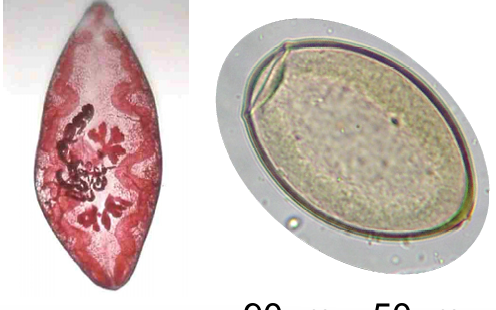 <p>Lung&nbsp;Fluke</p><p>Dogs, cat, and people</p>
