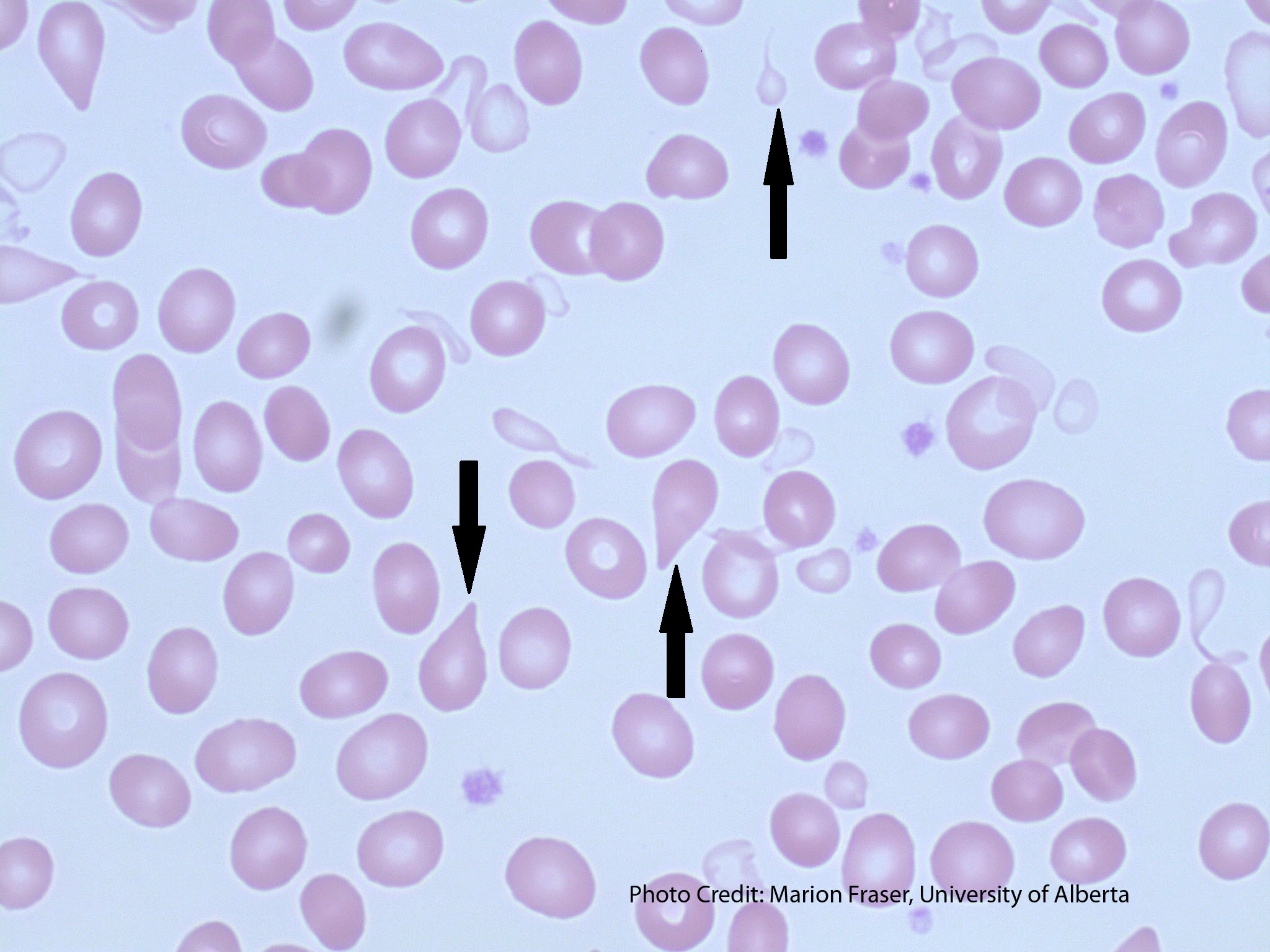<p>DACROCYTES</p>