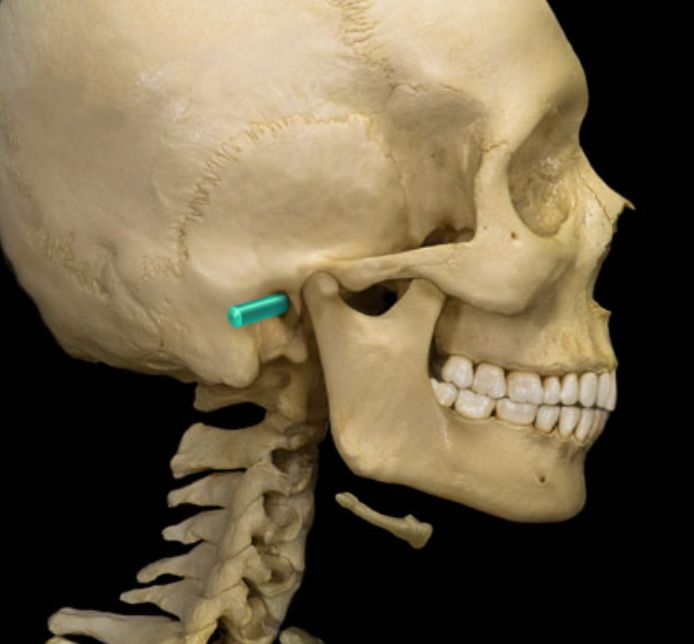 term image