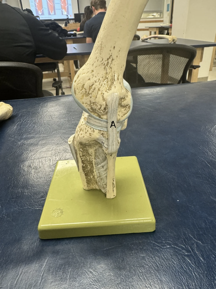 <p><span>Label this Ligament</span></p>