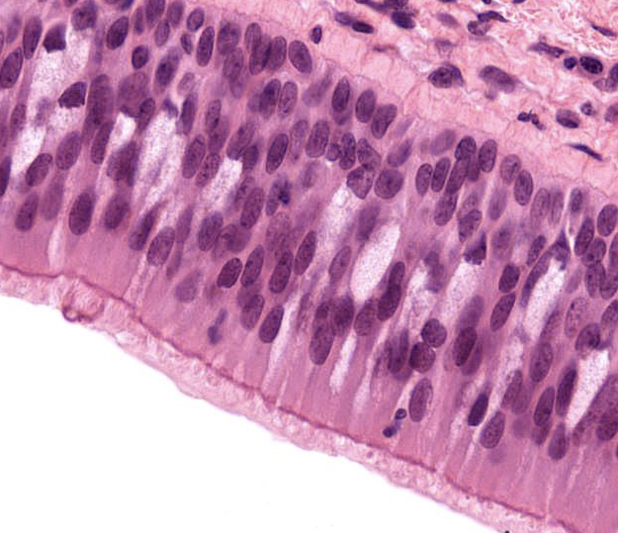 <p>tissue type</p>