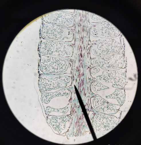 <ol><li><p>What is the phylum (naked seed)</p></li><li><p>Name specific </p></li></ol><p></p>