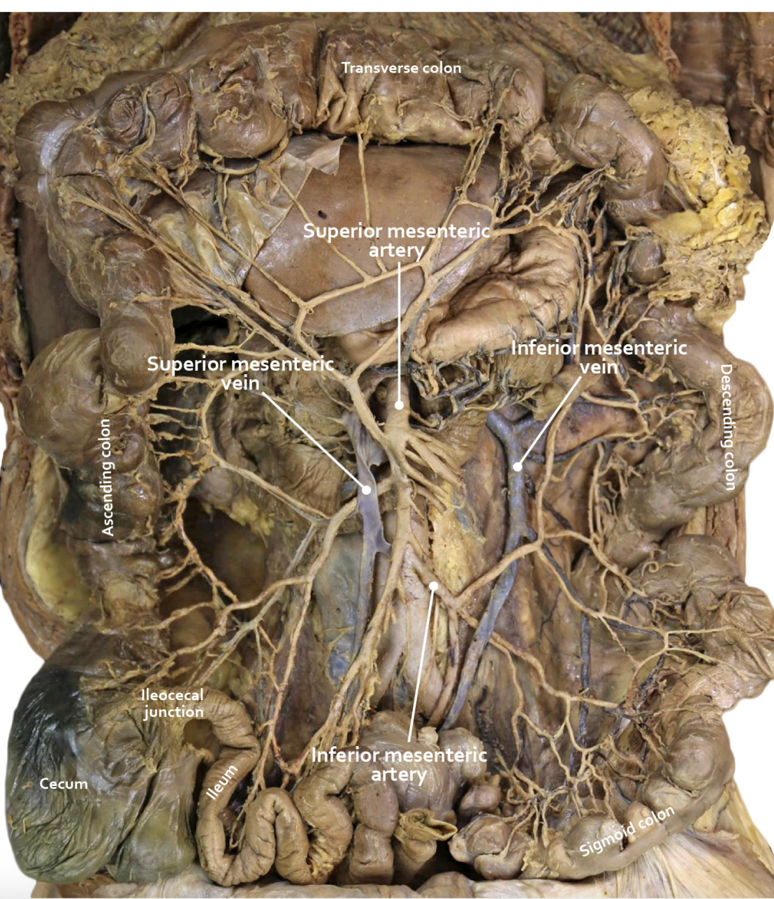 <p>third branch off of the abdominal aorta </p>