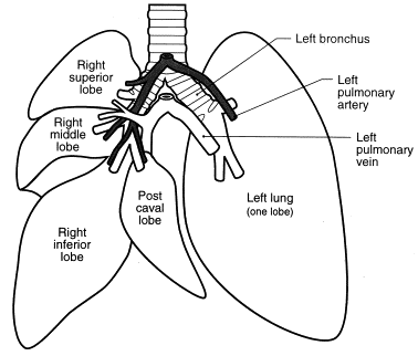 <p>Bronchi</p>