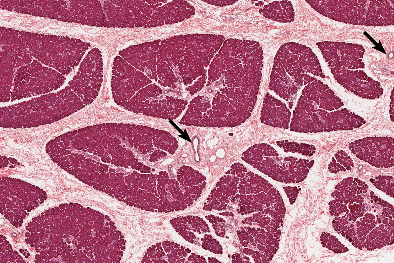 <p>Salivary Gland </p><p><strong>NOTICE: THE OPEN SPACES WHICH IS THE DUCTS THAT THE SECRETIONS ARE RELEASED THROUGH</strong></p>