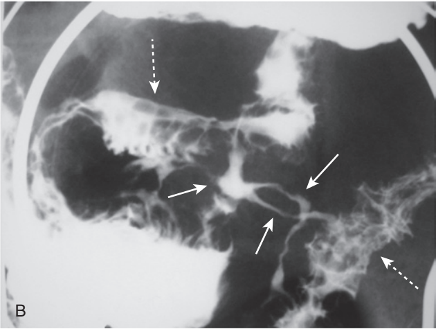 <p>diagnosis</p>