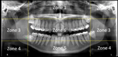 <p>• inferior border of mandible</p><p>• mental ridges</p>