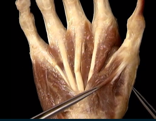 <p>Diep, Handpalm 2 spieren onder de m. policis brevis</p>