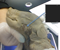 <p>cheek muscle</p>