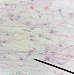 <p>What kind of tissue is this?</p>