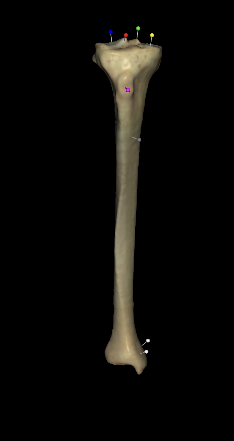 <p>On the right tibia what is the grey tag located?</p>