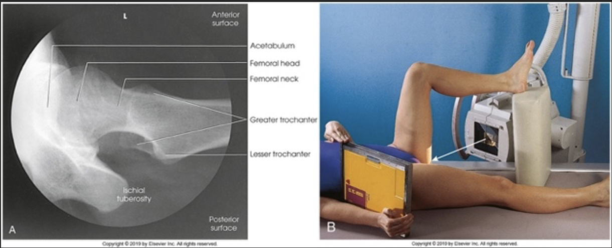 <p>What structure is seen in profile</p>