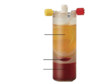 <p>what are labels (top to bottom)</p>