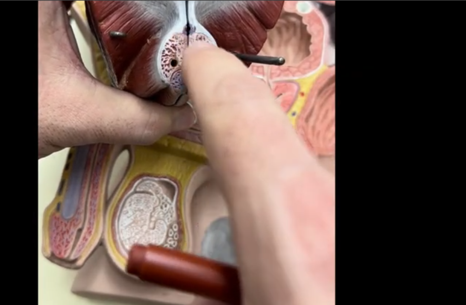 <p>Superficial dorsal vein</p>