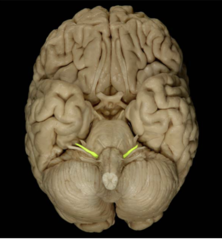 <p>what cranial nerve is the highlighted section</p>