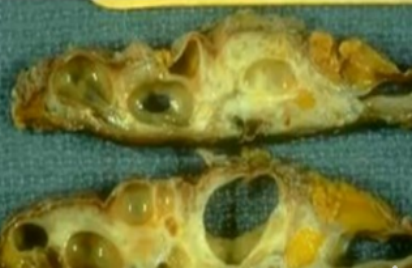 <p>What pathology? </p>