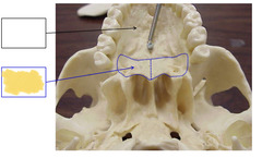 <p>Inferior View of Skull - Mandible Removed</p>