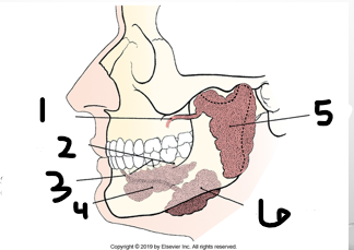 <p>what salivary gland is 3?</p>