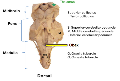 <p>dorsal view of the brainstem</p><p>cerebellum mostly removed here, <span style="background-color: transparent;">Thalamus, pineal gland, colliculi sup and inf, &nbsp;trochlear nerve, dorsal columns sensory from spine terminate in the gracile and cuneate nuclei seen as tubercles</span></p>
