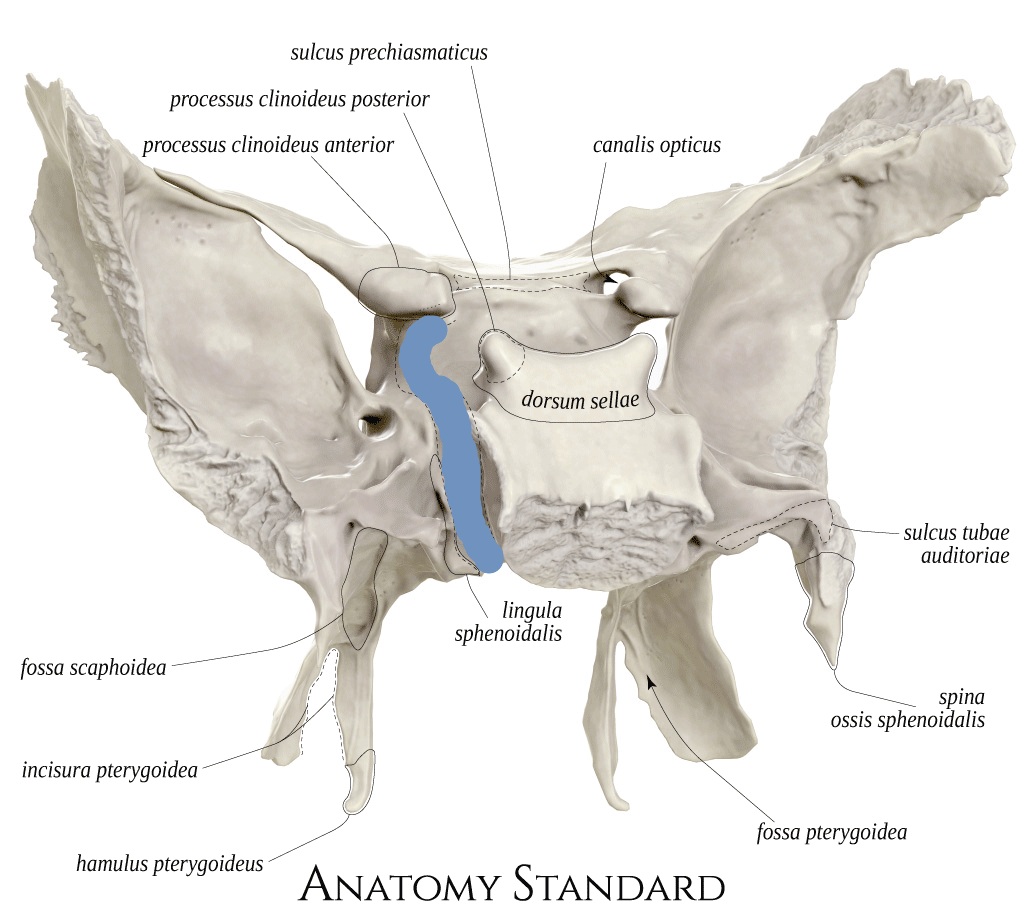 term image