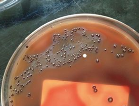 <p>neg; anaerobic; facultative</p>