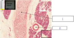 <p>What is the structure at 1</p>