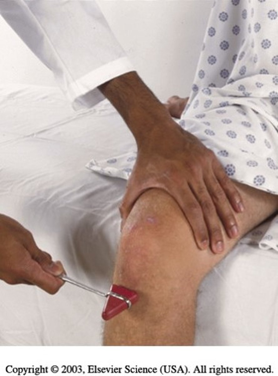 <p>let lower legs dangle to flex knee/stretch tendons, strike tendon directly just below patella</p><p>normally lower leg extends</p>