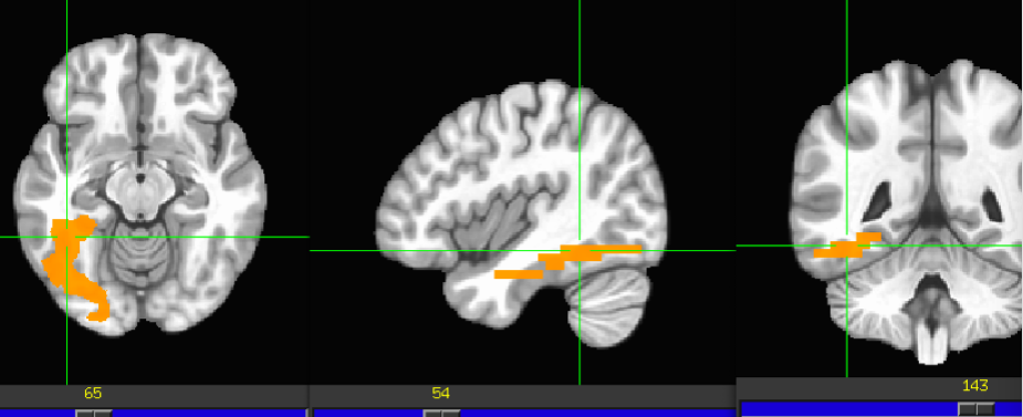 term image
