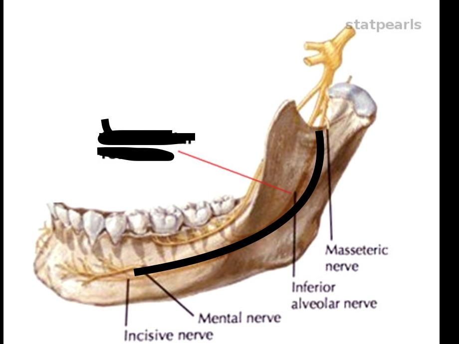 <p>jaw bone; intent</p>