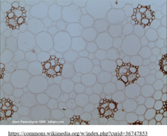 <p>parenchyma</p>