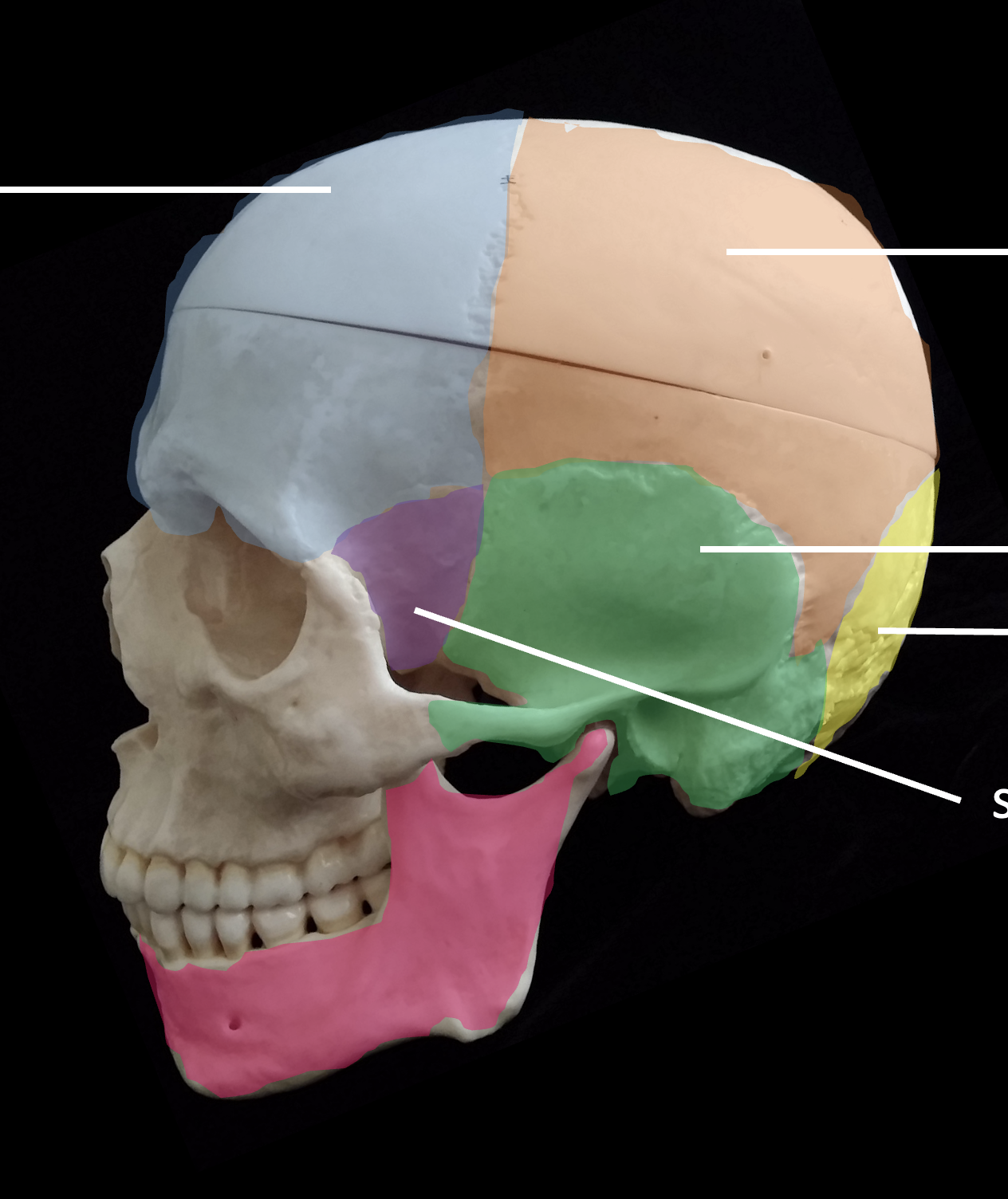 <p>Whats the pink region highlighted?</p>