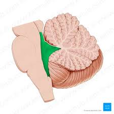 <ul><li><p>4e ventrikel</p></li><li><p>Liquorruimte tussen pons/cerebellum</p></li></ul><p></p>