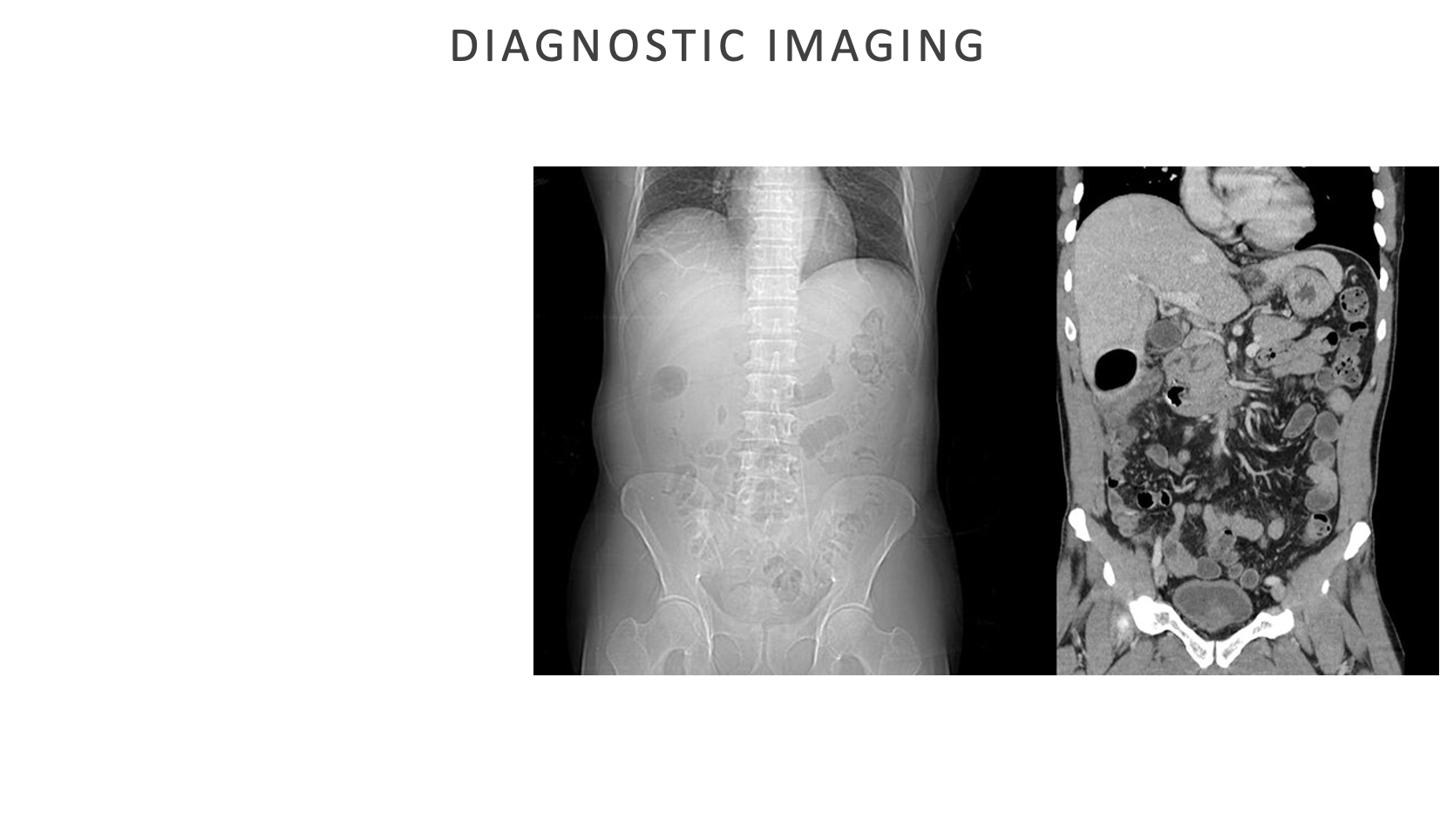 <p>Abdominal imaging tests help identify structural problems, inflammation, infections, or cancer </p>