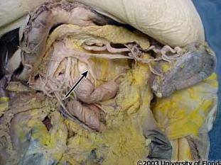 <p>what vein is pictured here?</p>