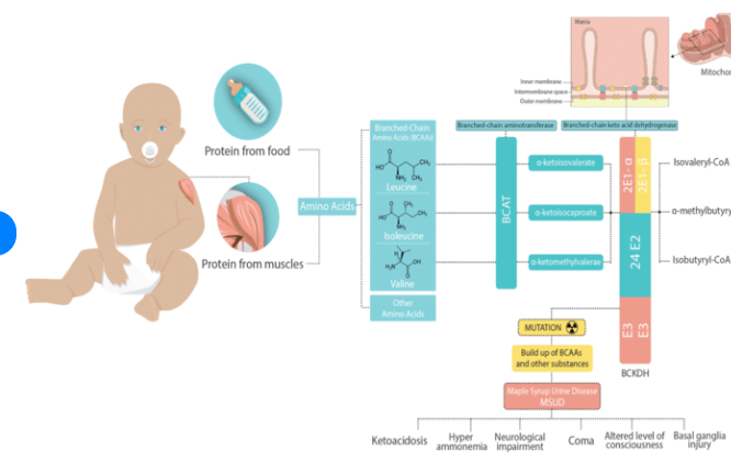 <p>What is a rare, genetic disorder affecting the catabolism of branched- chain amino acids (BCAAs) </p>