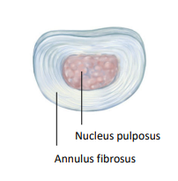 <p>Notochordal cells enclosed by the annulus fibrosus differentiate to form the nucleus pulposus of the disc. The regions of the notochord enclosed by the developing vertebral bodies degenerate and disappear.</p>