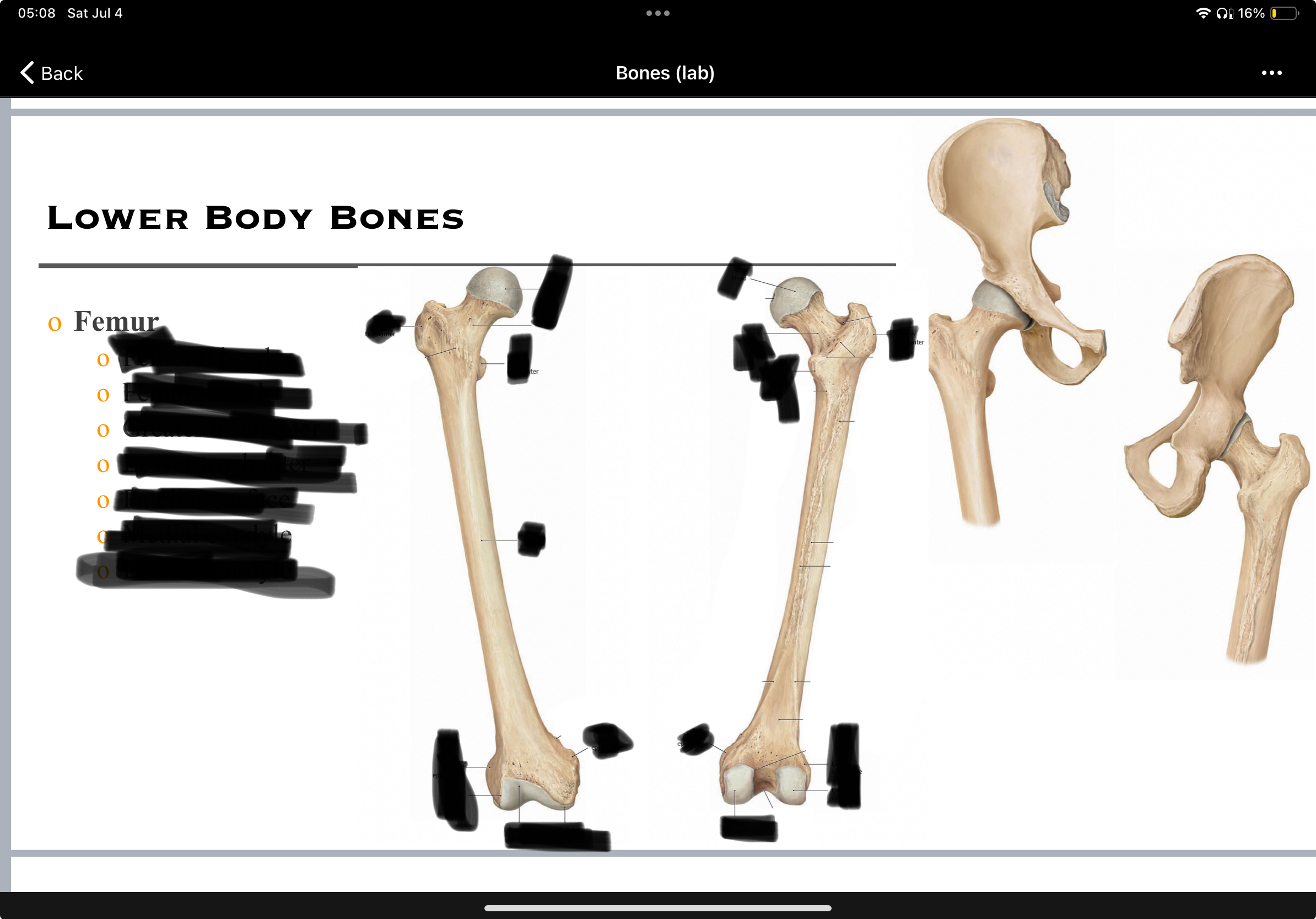 <p>name the parts if the femur</p>