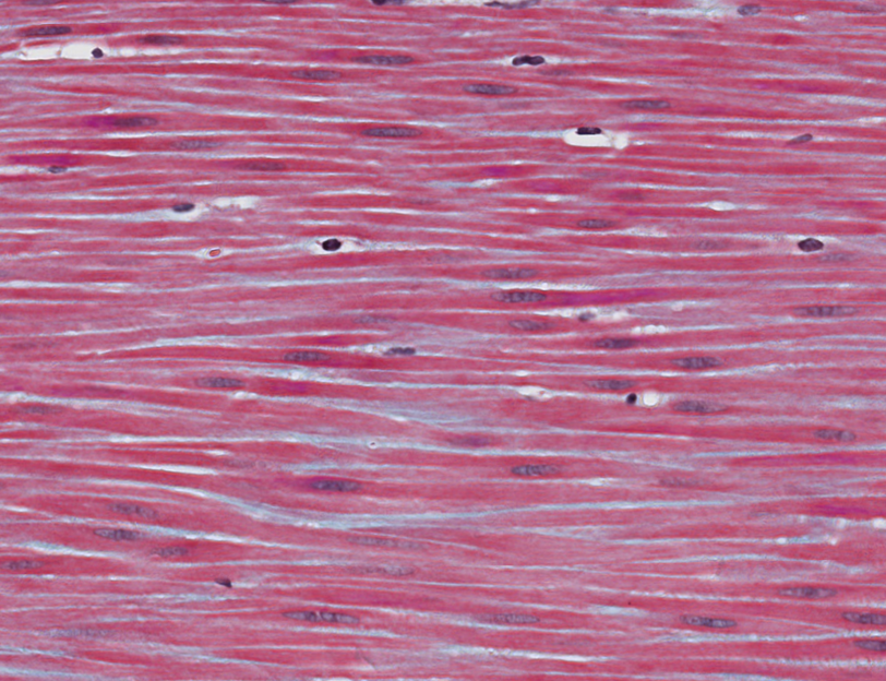 <p><span style="font-family: "Calibri Light";">What is the shape of these smooth muscle myofibers?</span></p>