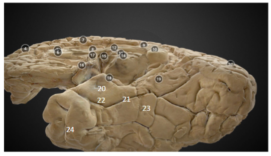 <p>18 - anterior extremity of parahippocampal gyrus</p>
