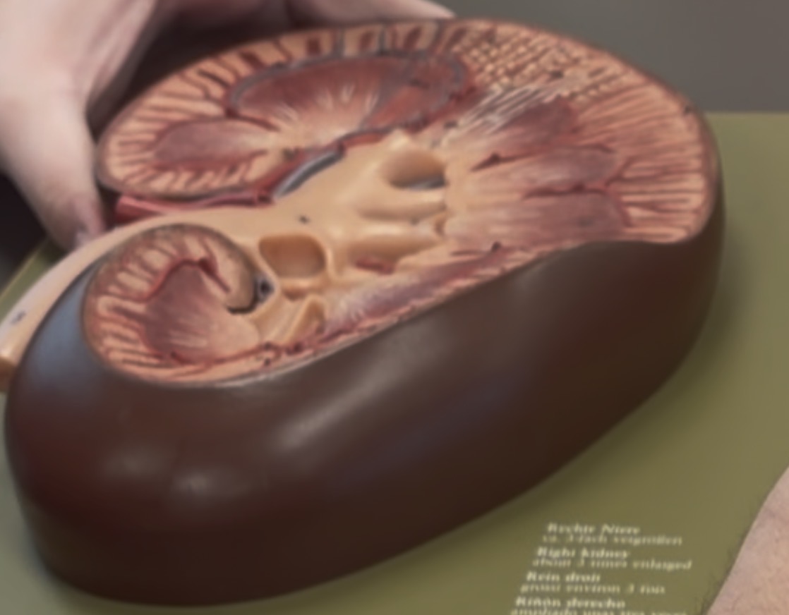 <p>Renal Capsule surrounds the kidney</p>