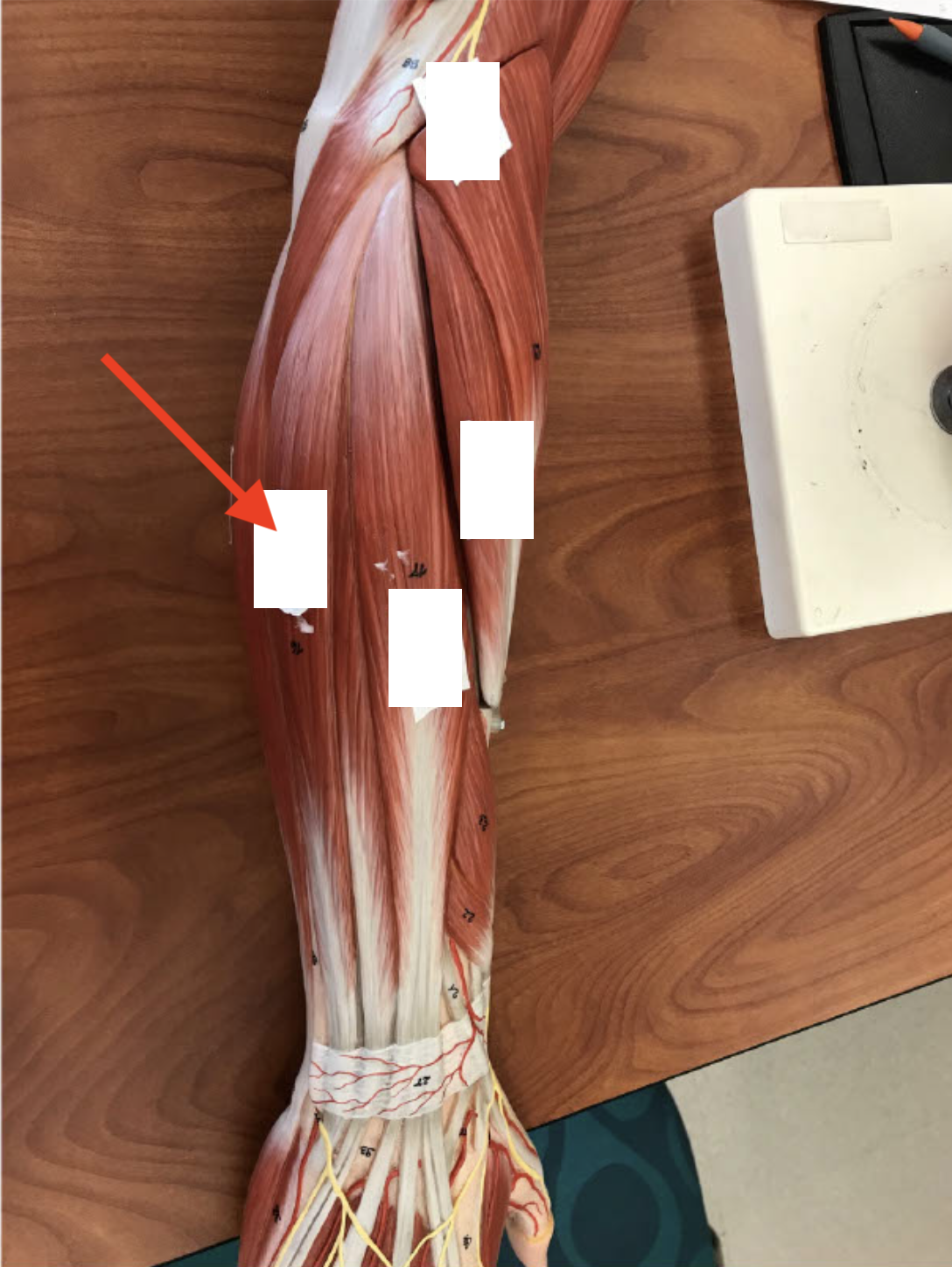 <p>Extensor Carpi Ulnaris</p>