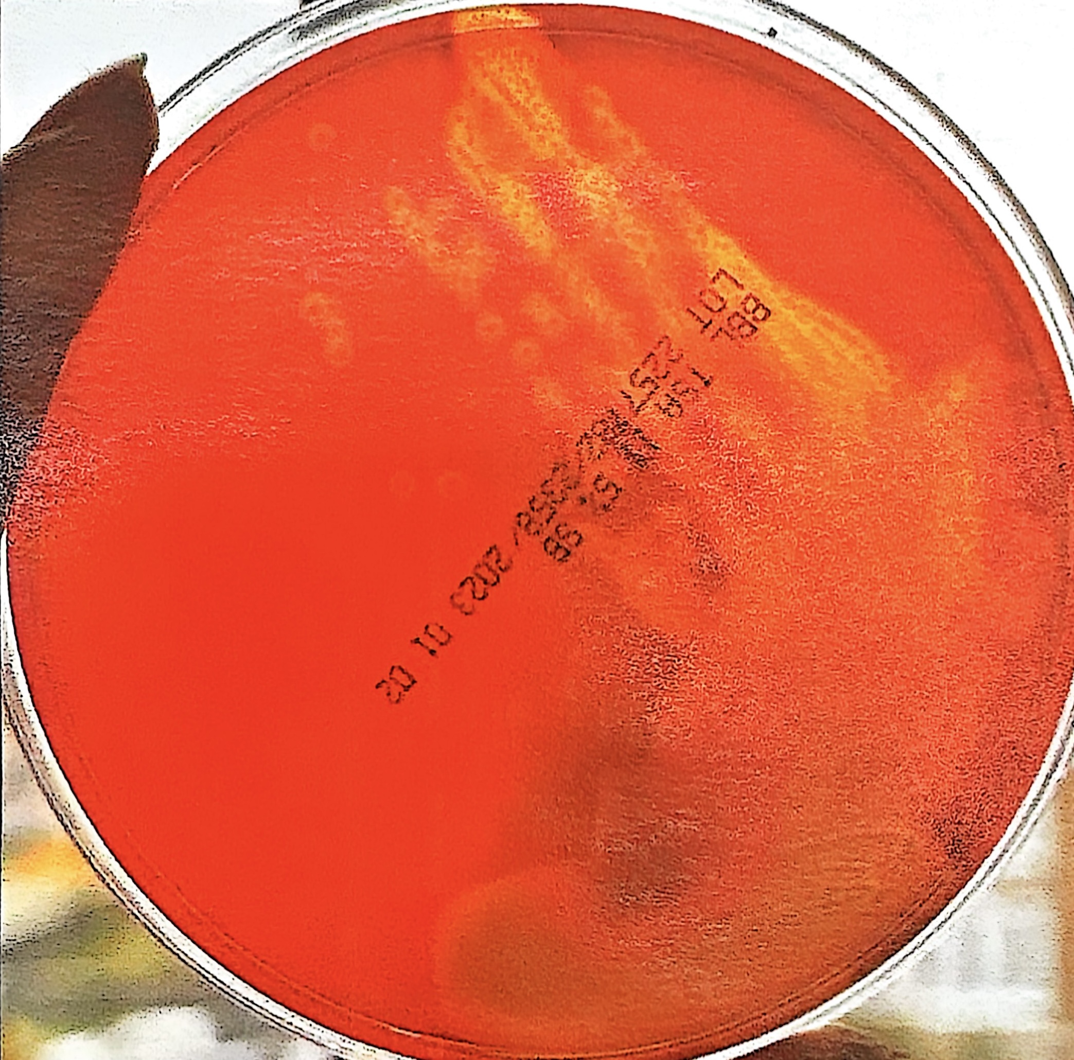 <p>zone of clearing around the colony in SBA. <em>Staph aureus</em> and group A and B strep </p>